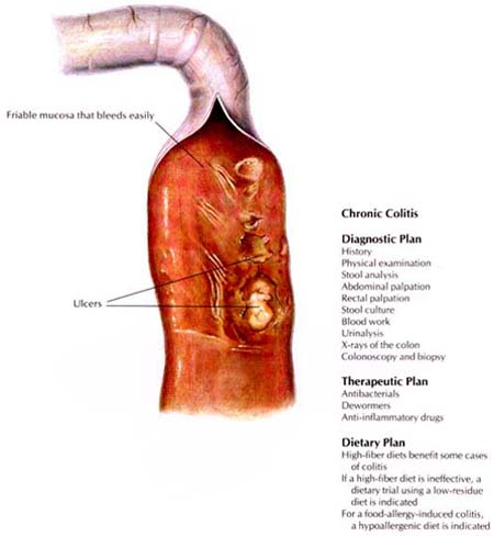 Chronic Colitis