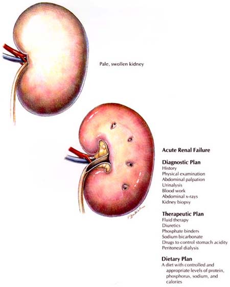 Acute Renal Failure