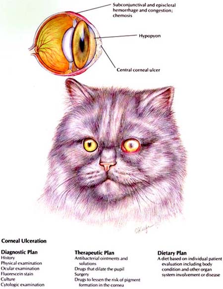 Corneal Ulceration