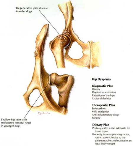 Hip Dysplasia