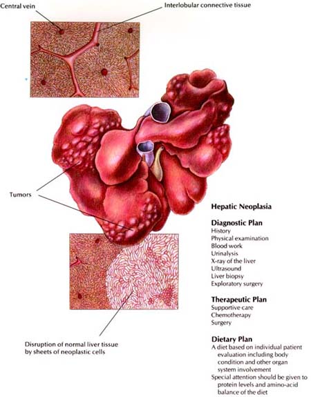 Hepatic Neoplasia